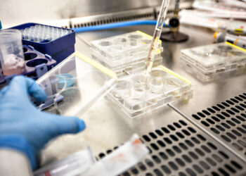 Biotechnological Advances in the Diagnosis and Management of Parasitic Infections and HIV Co-infection