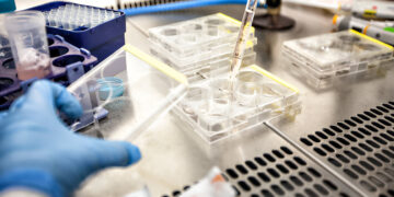 Biotechnological Advances in the Diagnosis and Management of Parasitic Infections and HIV Co-infection