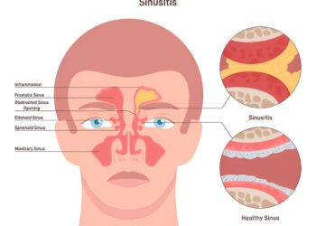 Bacterial Infections of the Human Respiratory Tract (BIHRT)